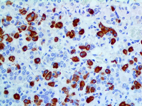 IHC of Growth Hormone RMab on an FFPE Pituitary Tissue